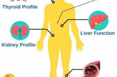 Redcliffe Labs -  Full Body Checkup In Pune