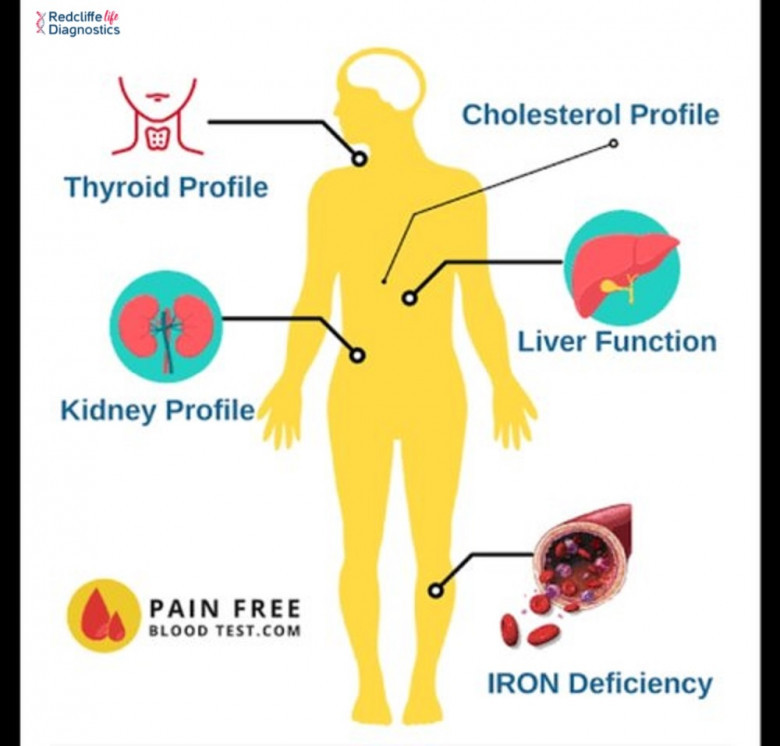 Redcliffe Labs -  Full Body Checkup In Pune