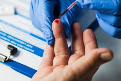 iron blood test | iron anemia blood test - Anna Pharmacy