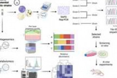 Global Polymerase Chain Reaction (PCR) In Agro-Food Market Report by size, cagr analysis, growth factors, top trends, and forecast 2028