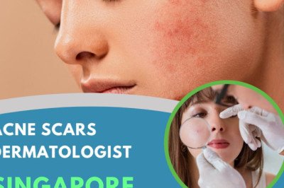Get Smoother Skin Today: Acne Scars Dermatologist in Singapore