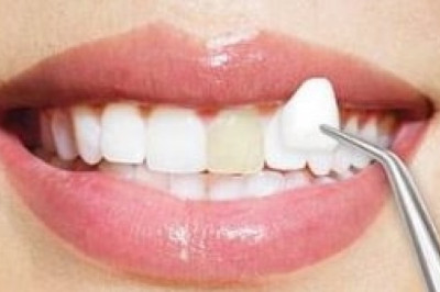 The Cheapest Dentist or Best Dentist In San Diego - What's Your Pick?
